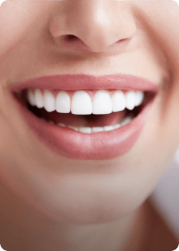 A woman with a joyful smile, her white teeth prominently visible, conveying a sense of warmth and friendliness.