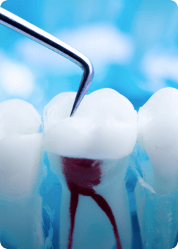A toothbrush with a tooth being extracted from its bristles, highlighting the importance of oral care.