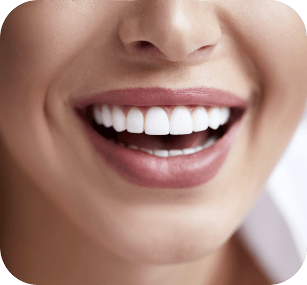 A woman with bright white teeth smiling warmly at the camera, showcasing her cheerful expression.