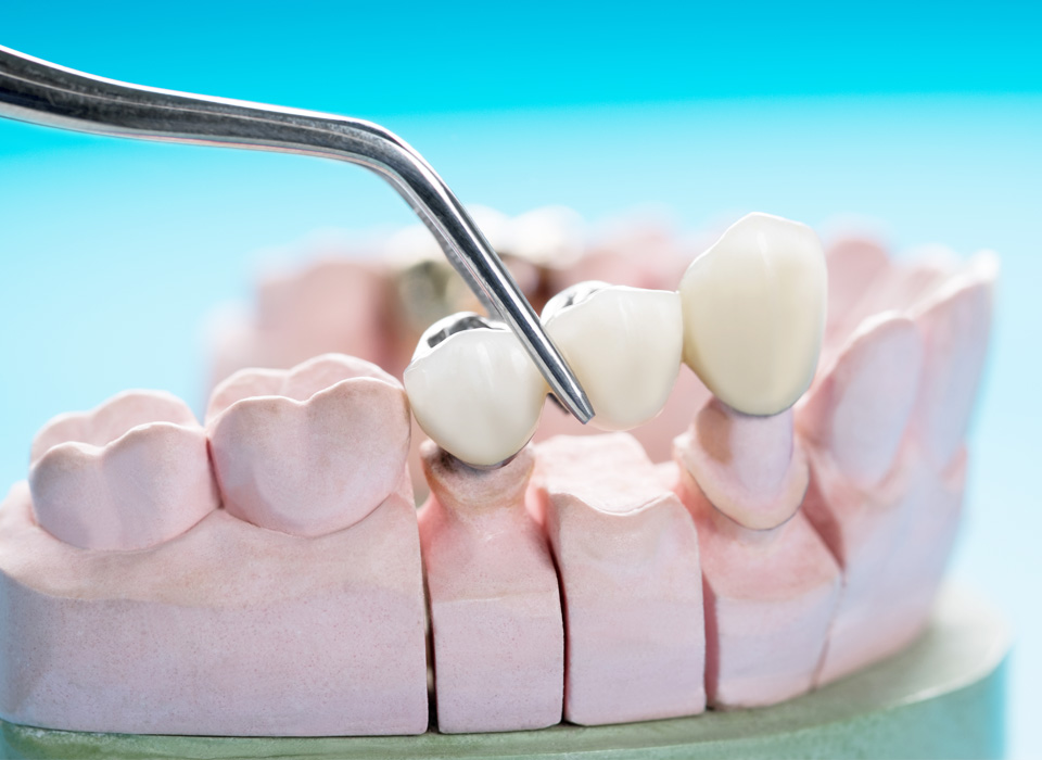 Dental instruments and a teeth model displayed on a blue background, representing tools used in dentistry and oral hygiene.