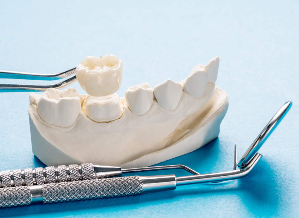 Dental tools and a teeth model arranged on a blue background, showcasing instruments used for oral health care.