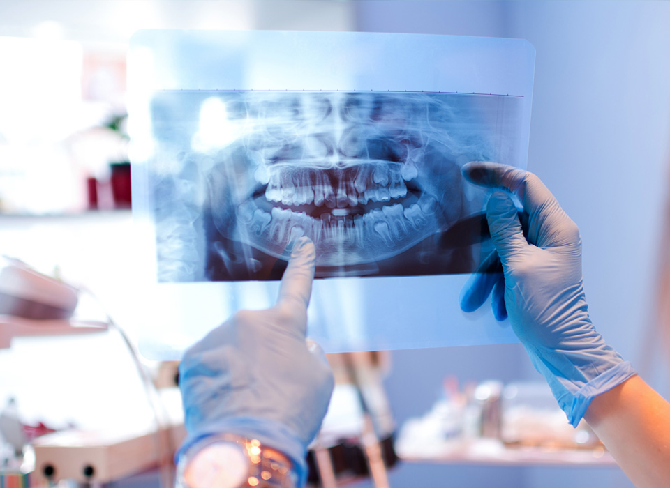A person holds an X-ray image displaying a detailed view of a tooth, highlighting its structure and condition.