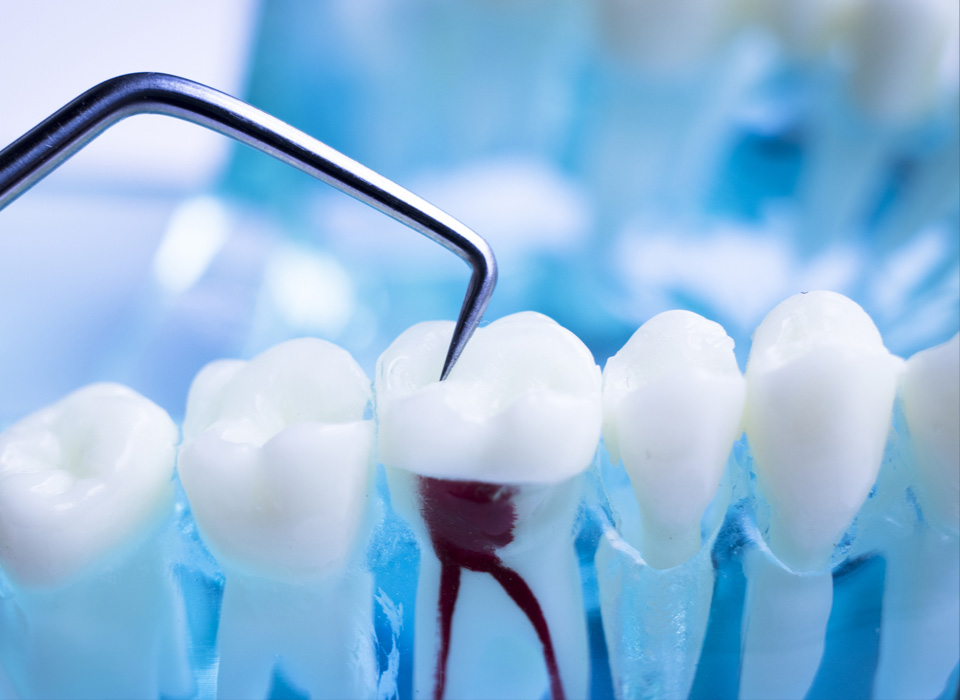 A close-up of a toothbrush with a tooth being pulled from its bristles, illustrating dental hygiene practices.