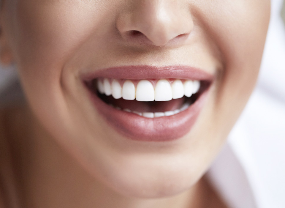A woman with bright white teeth smiling warmly at the camera, showcasing her cheerful expression.