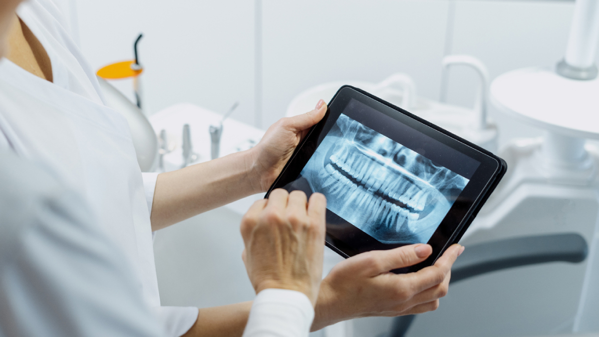 Featured image for How Often Should You Get a Dental X-Ray?