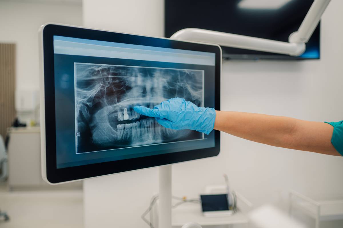 Dentist pointing at teeth x-ray on digital monitor in clinic