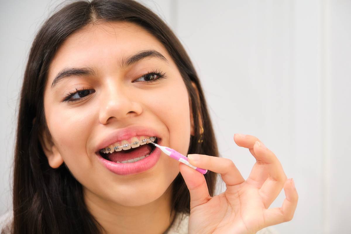 Female teenager cleaning her braces with an interdental brush.